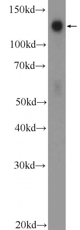 HeLa cells were subjected to SDS PAGE followed by western blot with Catalog No:115969(TACC3 Antibody) at dilution of 1:600
