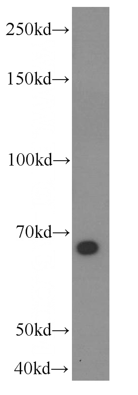 PC-3 cells were subjected to SDS PAGE followed by western blot with Catalog No:107632(TP63 Antibody) at dilution of 1:1000