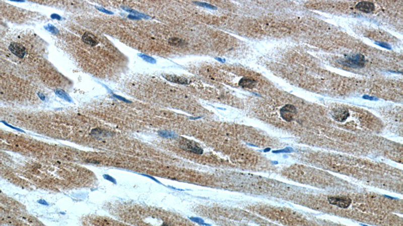 Immunohistochemical of paraffin-embedded human heart using Catalog No:109610(CSRP3 antibody) at dilution of 1:50 (under 40x lens)