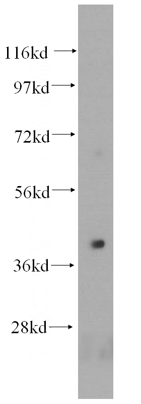 human liver tissue were subjected to SDS PAGE followed by western blot with Catalog No:111429(HLA-E antibody) at dilution of 1:500