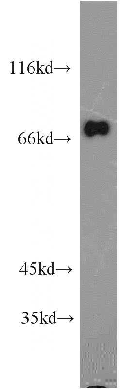 mouse brain tissue were subjected to SDS PAGE followed by western blot with Catalog No:110957(GGA2 antibody) at dilution of 1:1000