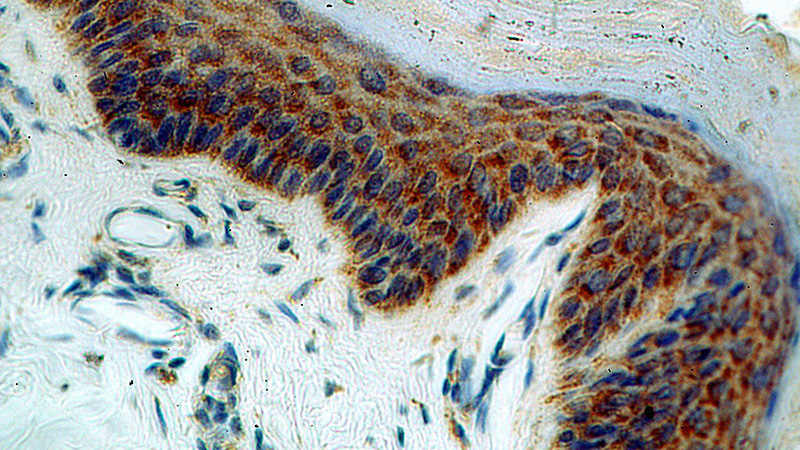 Immunohistochemical of paraffin-embedded human skin using Catalog No:114313(PTPIP51 antibody) at dilution of 1:100 (under 40x lens)