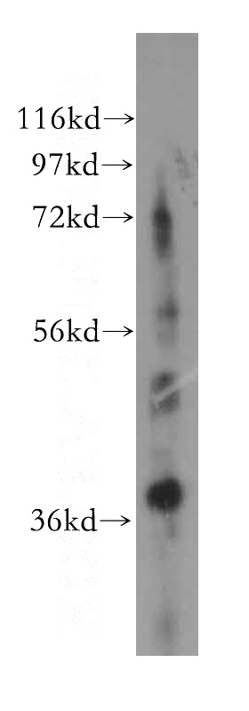 human liver tissue were subjected to SDS PAGE followed by western blot with Catalog No:110996(GNB3 antibody) at dilution of 1:500