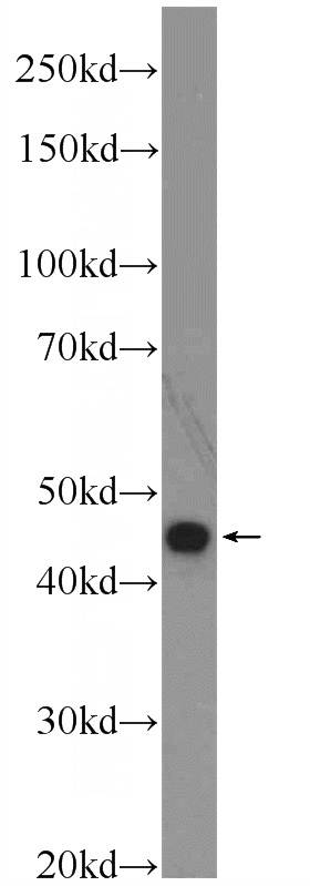 A549 cells were subjected to SDS PAGE followed by western blot with Catalog No:112321(LRP2BP Antibody) at dilution of 1:1000