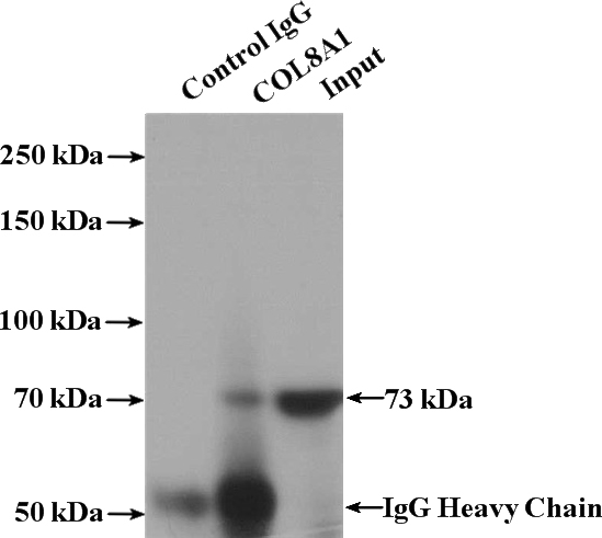 IP Result of anti-COL8A1 (IP:Catalog No:109440, 4ug; Detection:Catalog No:109440 1:500) with HepG2 cells lysate 1800ug.