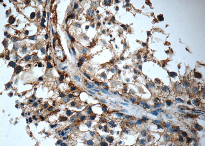 Immunohistochemistry of paraffin-embedded human testis tissue slide using Catalog No:116283(TMX3 Antibody) at dilution of 1:50 (under 40x lens)