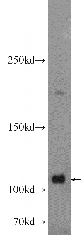 HeLa cells were subjected to SDS PAGE followed by western blot with Catalog No:107774(ADAR1 Antibody) at dilution of 1:1000