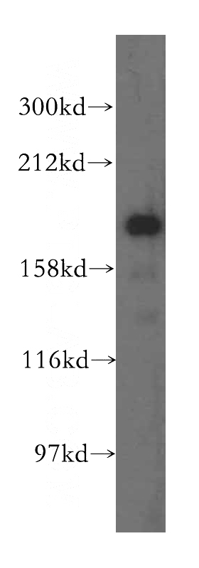 human heart tissue were subjected to SDS PAGE followed by western blot with Catalog No:110354(ERCC6L antibody) at dilution of 1:800