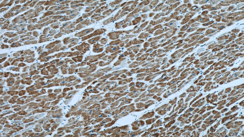 Immunohistochemical of paraffin-embedded human heart using Catalog No:113435(ATP5O antibody) at dilution of 1:50 (under 10x lens)