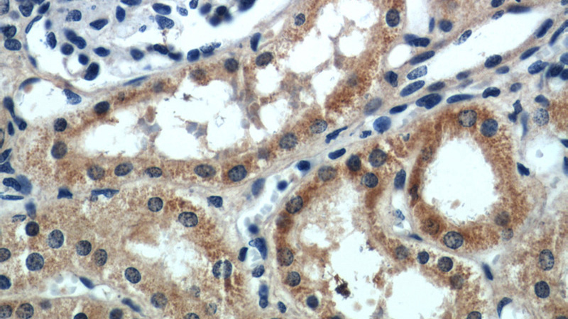 Immunohistochemical of paraffin-embedded human kidney using Catalog No:115357(SLIT2-Specific antibody) at dilution of 1:50 (under 40x lens)