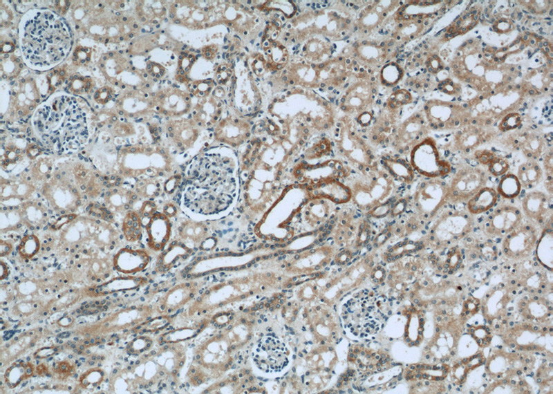 Immunohistochemical of paraffin-embedded human kidney using Catalog No:113526(OXER1 antibody) at dilution of 1:50 (under 10x lens)