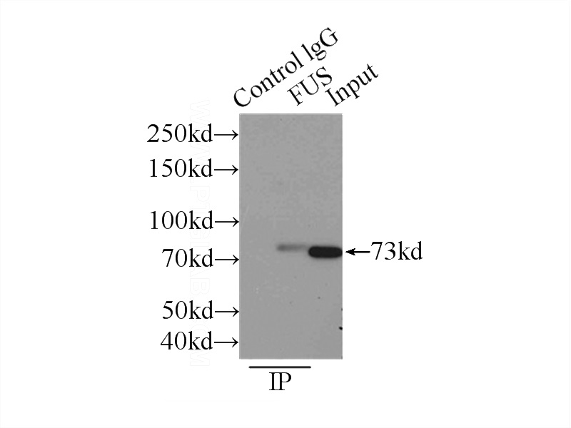 IP Result of anti-FUS (IP:Catalog No:110795, 3ug; Detection:Catalog No:110795 1:1000) with K-562 cells lysate 4000ug.