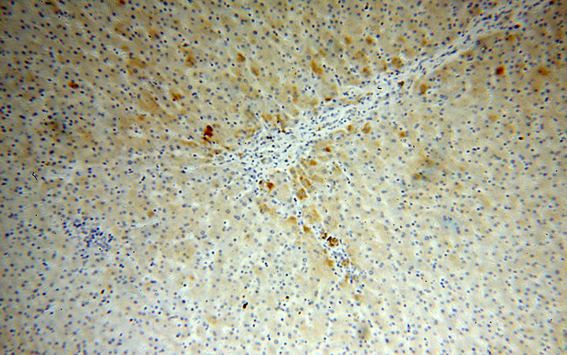Immunohistochemical of paraffin-embedded human liver using Catalog No:108022(APOA4 antibody) at dilution of 1:100 (under 10x lens)