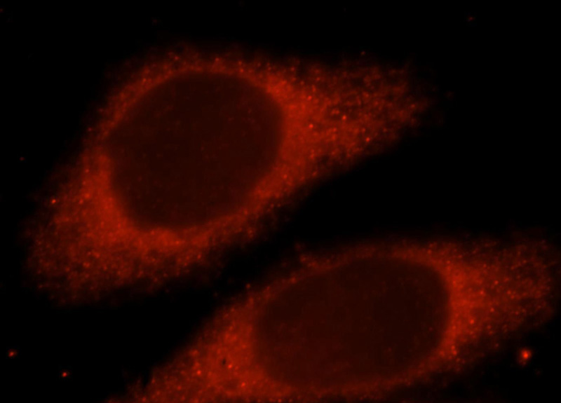 Immunofluorescent analysis of Hela cells, using LHPP antibody Catalog No:112215 at 1:25 dilution and Rhodamine-labeled goat anti-rabbit IgG (red).