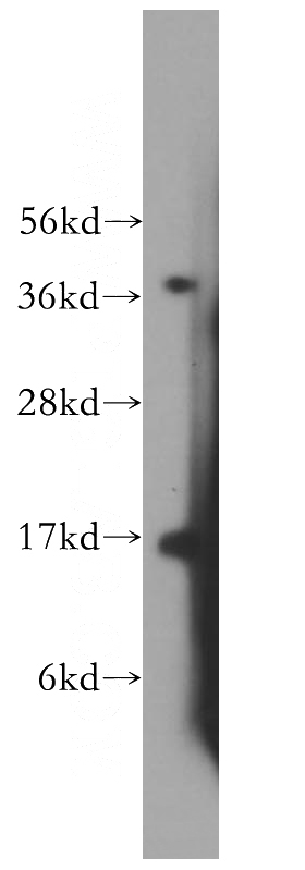 mouse testis tissue were subjected to SDS PAGE followed by western blot with Catalog No:112591(MED31 antibody) at dilution of 1:600