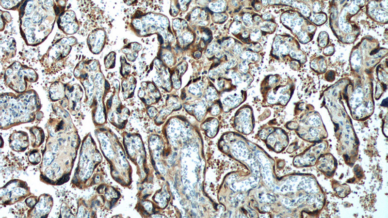 Immunohistochemistry of paraffin-embedded human placenta tissue slide using Catalog No:111281(CGA Antibody) at dilution of 1:200 (under 10x lens).