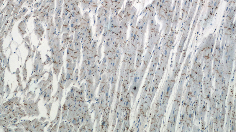 Immunohistochemistry of paraffin-embedded human heart tissue slide using (N-cadherin Antibody) at dilution of 1:200 (under 10x lens)