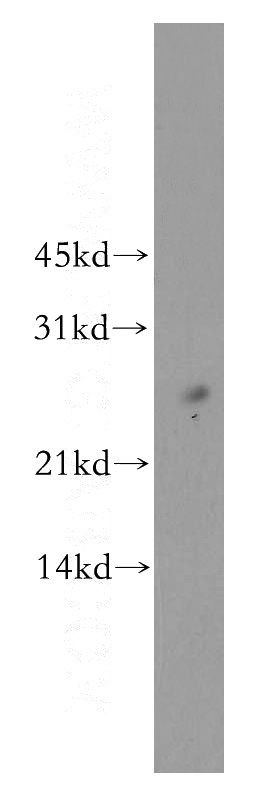 mouse lung tissue were subjected to SDS PAGE followed by western blot with Catalog No:113986(PNRC2 antibody) at dilution of 1:500