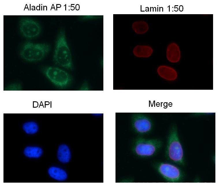 Immunofluorescent analysis of COS-7 cells using Catalog No:107952(AAAS Antibody) at dilution of 1:50 and Rhodamine-Goat anti-Rabbit IgG