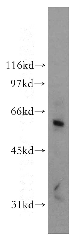 Jurkat cells were subjected to SDS PAGE followed by western blot with Catalog No:109752(DCLRE1B antibody) at dilution of 1:800