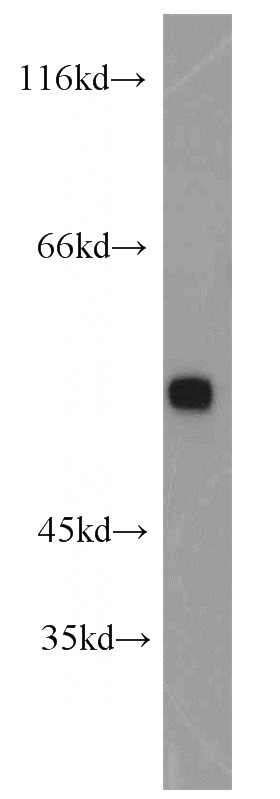 Jurkat cells were subjected to SDS PAGE followed by western blot with Catalog No:110051(DOK3 antibody) at dilution of 1:800