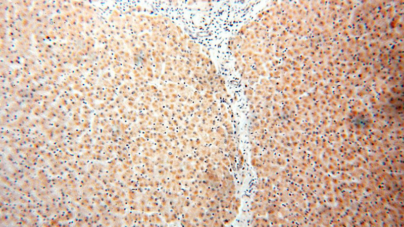 Immunohistochemical of paraffin-embedded human liver using Catalog No:109222(CHDH antibody) at dilution of 1:100 (under 10x lens)