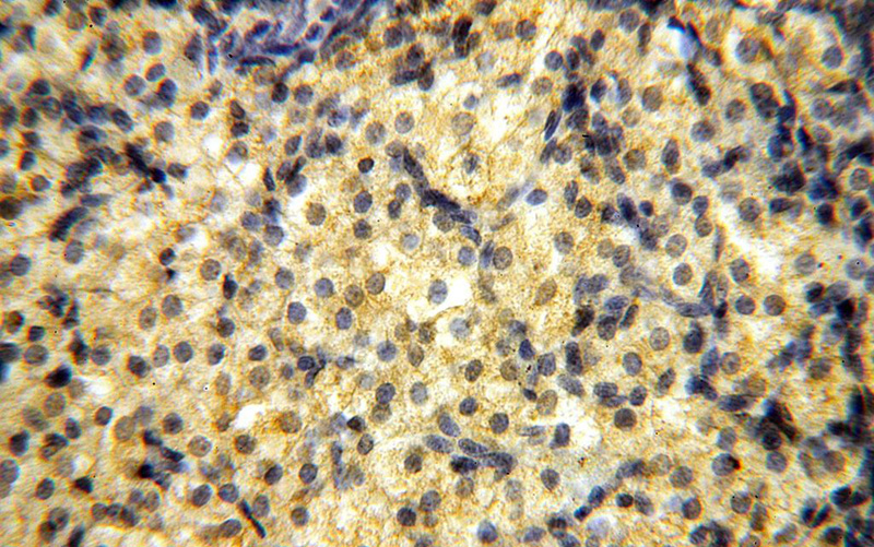 Immunohistochemical of paraffin-embedded human ovary using Catalog No:108109(ANTXR2 antibody) at dilution of 1:100 (under 40x lens)
