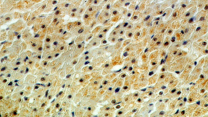 Immunohistochemical of paraffin-embedded human heart using Catalog No:114570(RCAN1 antibody) at dilution of 1:100 (under 40x lens)