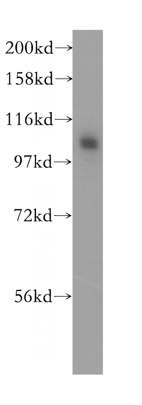 SH-SY5Y cells were subjected to SDS PAGE followed by western blot with Catalog No:107872(CTNNA2 antibody) at dilution of 1:1200