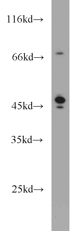 HepG2 cells were subjected to SDS PAGE followed by western blot with Catalog No:114222(SERPINA5 antibody) at dilution of 1:1000