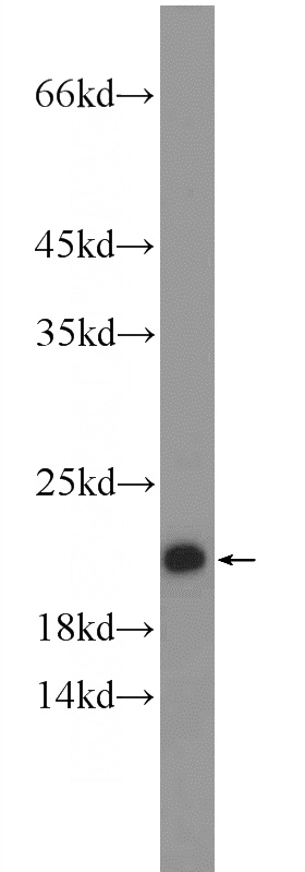 human plasma tissue were subjected to SDS PAGE followed by western blot with Catalog No:109383(CLEC3B Antibody) at dilution of 1:600