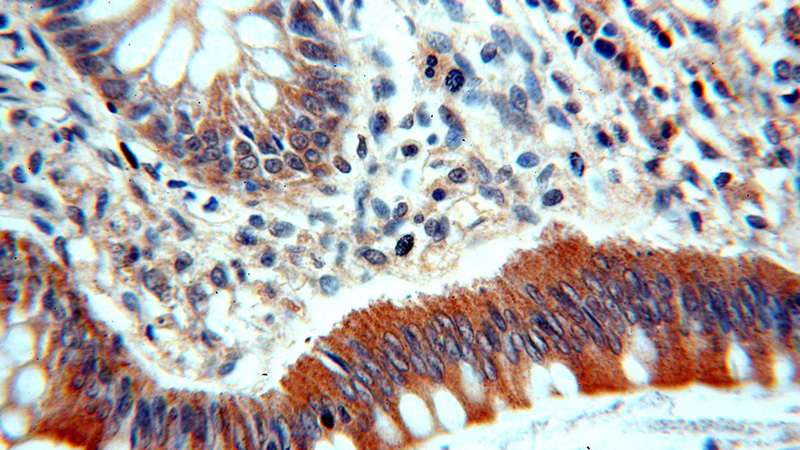 Immunohistochemical of paraffin-embedded human colon using Catalog No:116060(TINAG-Specific antibody) at dilution of 1:100 (under 40x lens)