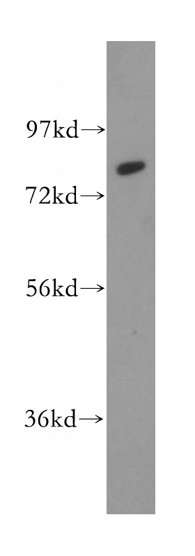 PC-3 cells were subjected to SDS PAGE followed by western blot with Catalog No:108834(CAPN11 antibody) at dilution of 1:1000