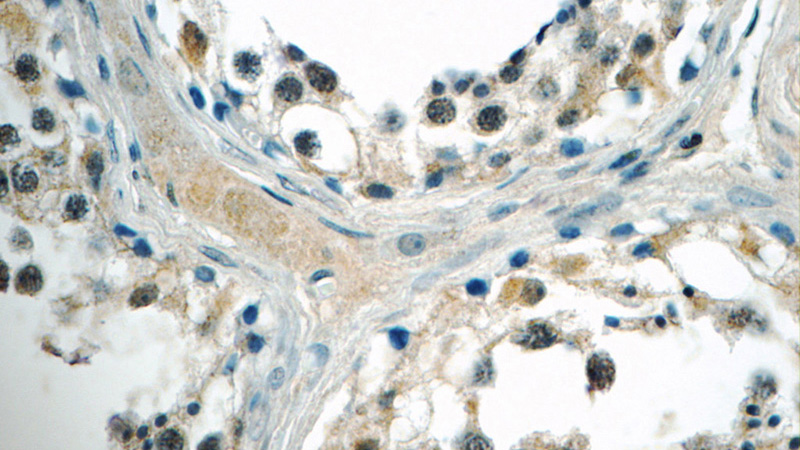 Immunohistochemistry of paraffin-embedded human testis tissue slide using Catalog No:112586(MED19 Antibody) at dilution of 1:50 (under 40x lens)