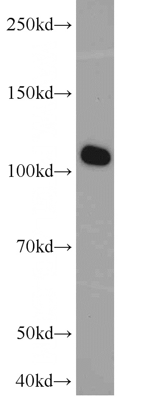 K-562 cells were subjected to SDS PAGE followed by western blot with Catalog No:107805(ABCF1 antibody) at dilution of 1:1500