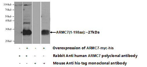 Transfected HEK-293 cells were subjected to SDS PAGE followed by western blot with Catalog No:108151(ARMC7 Antibody) at dilution of 1:1000