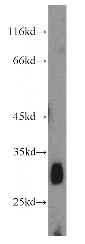 mouse small intestine tissue were subjected to SDS PAGE followed by western blot with Catalog No:111449(PGDS antibody) at dilution of 1:1000