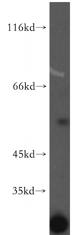 mouse skeletal muscle tissue were subjected to SDS PAGE followed by western blot with Catalog No:113634(PDP2 antibody) at dilution of 1:300