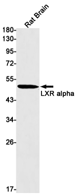 Western blot detection of LXR alpha in Rat Brain lysates using LXR alpha Rabbit mAb(1:1000 diluted).Predicted band size:50kDa.Observed band size:50kDa.