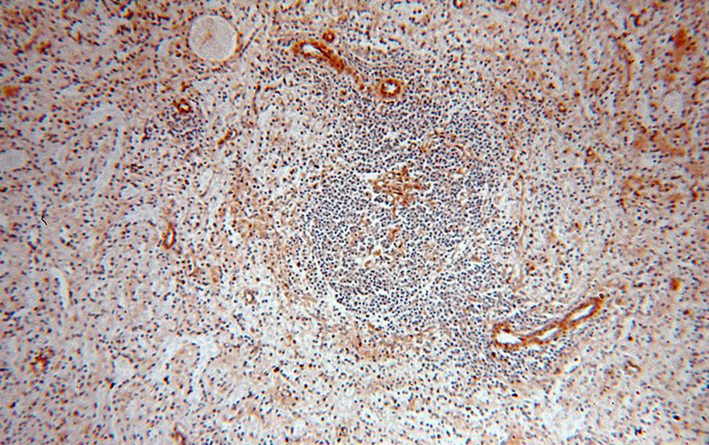 Immunohistochemical of paraffin-embedded human spleen using Catalog No:116211(TPPP antibody) at dilution of 1:100 (under 10x lens)