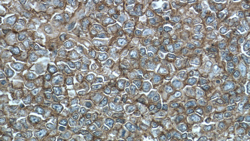 Immunohistochemistry of paraffin-embedded human tonsillitis tissue slide using Catalog No:107263(HLA class I (HLA-A) Antibody) at dilution of 1:200 (under 40x lens)