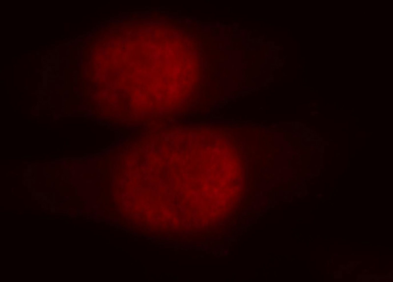 Immunofluorescent analysis of HepG2 cells, using UBR2 antibody Catalog No:116663 at 1:25 dilution and Rhodamine-labeled goat anti-rabbit IgG (red).
