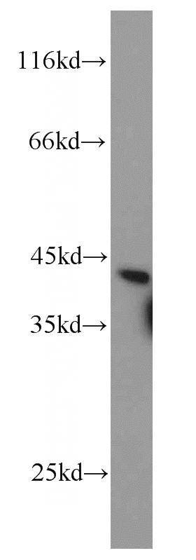 human kidney tissue were subjected to SDS PAGE followed by western blot with Catalog No:114583(RDH10 antibody) at dilution of 1:1000