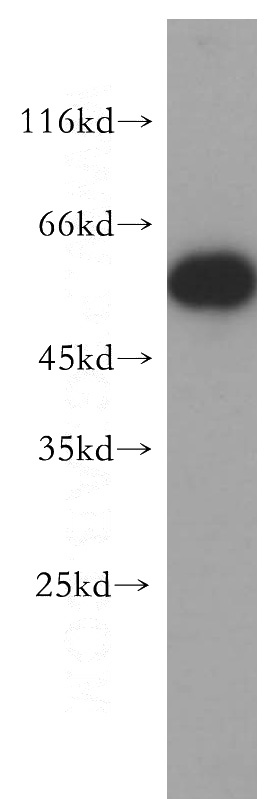 HepG2 cells were subjected to SDS PAGE followed by western blot with Catalog No:110525(FARSA antibody) at dilution of 1:500