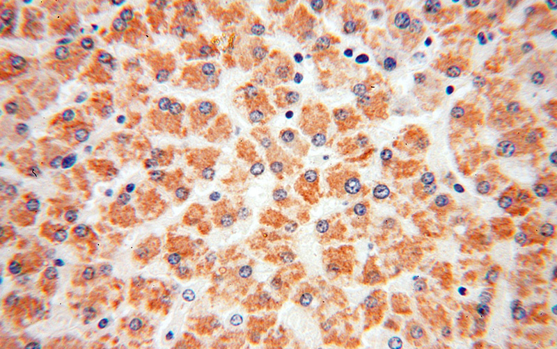 Immunohistochemical of paraffin-embedded human liver using Catalog No:112766(MTCH2 antibody) at dilution of 1:100 (under 40x lens)