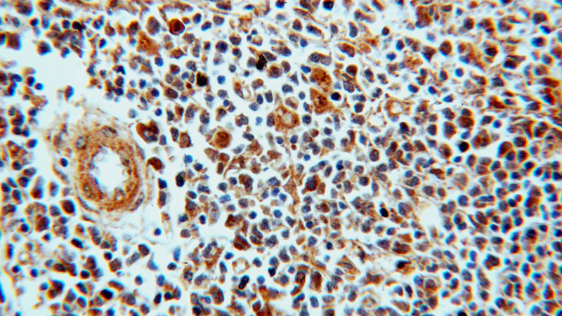 Immunohistochemical of paraffin-embedded human spleen using Catalog No:112191(LEF1 antibody) at dilution of 1:100 (under 40x lens)