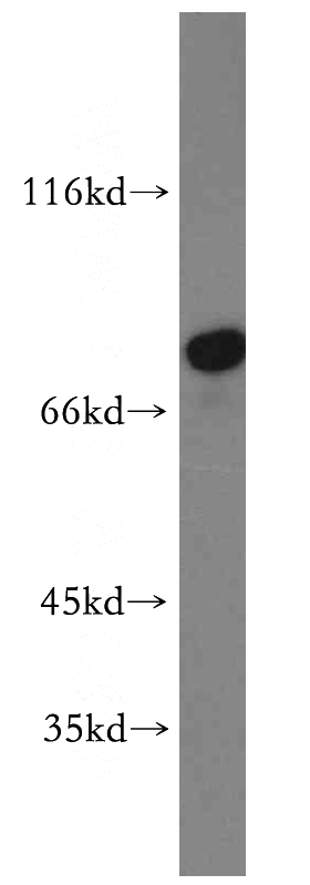 mouse skeletal muscle tissue were subjected to SDS PAGE followed by western blot with Catalog No:108001(AMPD1-Specific antibody) at dilution of 1:300