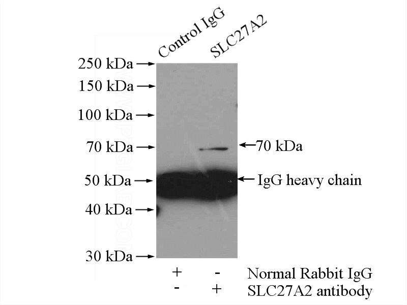 IP Result of anti-SLC27A2 (IP:Catalog No:115362, 4ug; Detection:Catalog No:115362 1:500) with HepG2 cells lysate 3200ug.