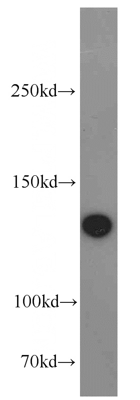 HeLa cells were subjected to SDS PAGE followed by western blot with Catalog No:115138(SF3B3 antibody) at dilution of 1:10000