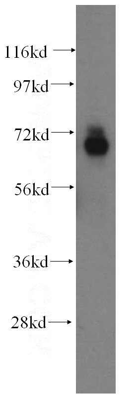 mouse brain tissue were subjected to SDS PAGE followed by western blot with Catalog No:107771(ADAMTSL4 antibody) at dilution of 1:500